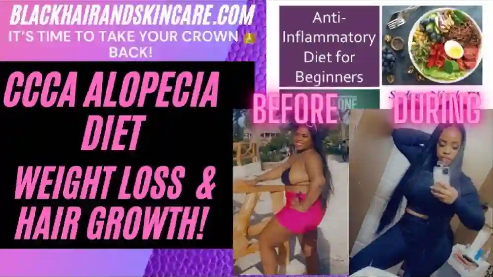 Ccca Alopecia Diet